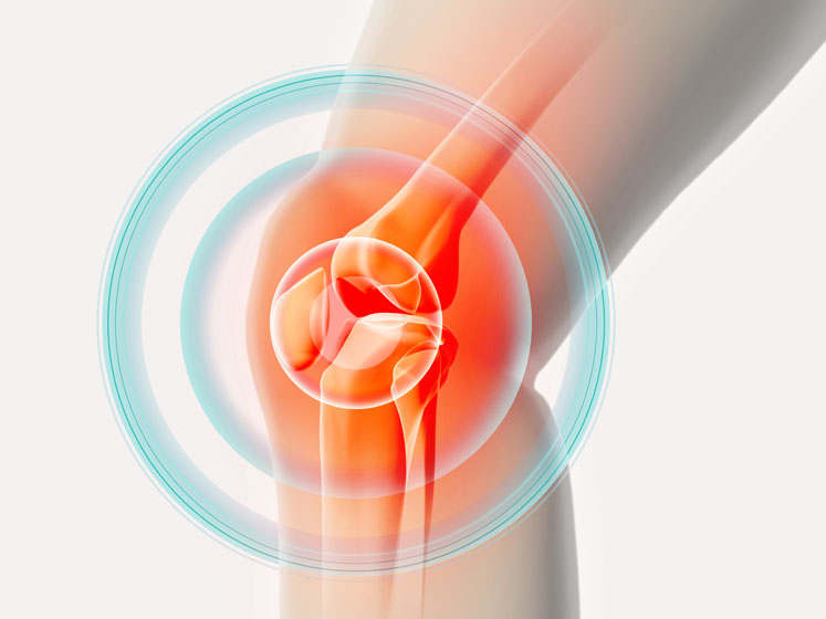 Complex Coronary Angioplasty