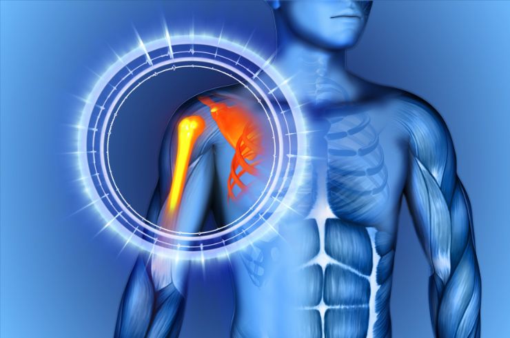 Arthroscopic Shoulder Rotator Cuff Surgery------33