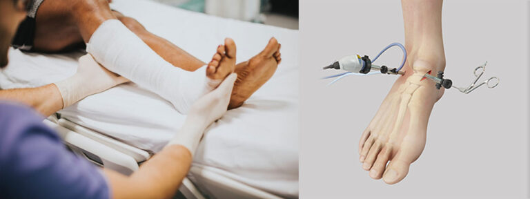 foot-and-ankle-arthroscopy-top