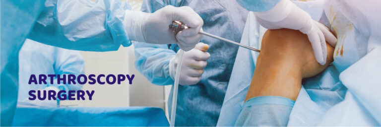 knee-arthroscopy-top