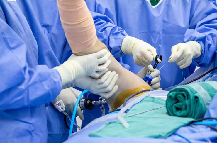 reverse-shoulder-replacement-surgery