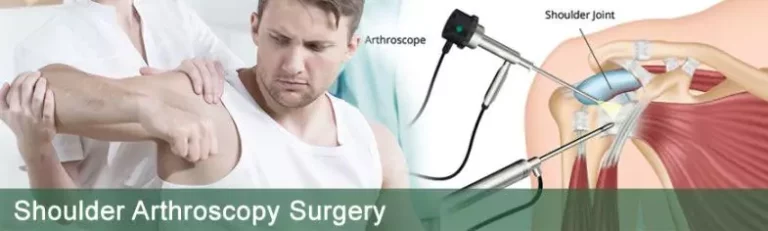 shoulder-arthroscopy